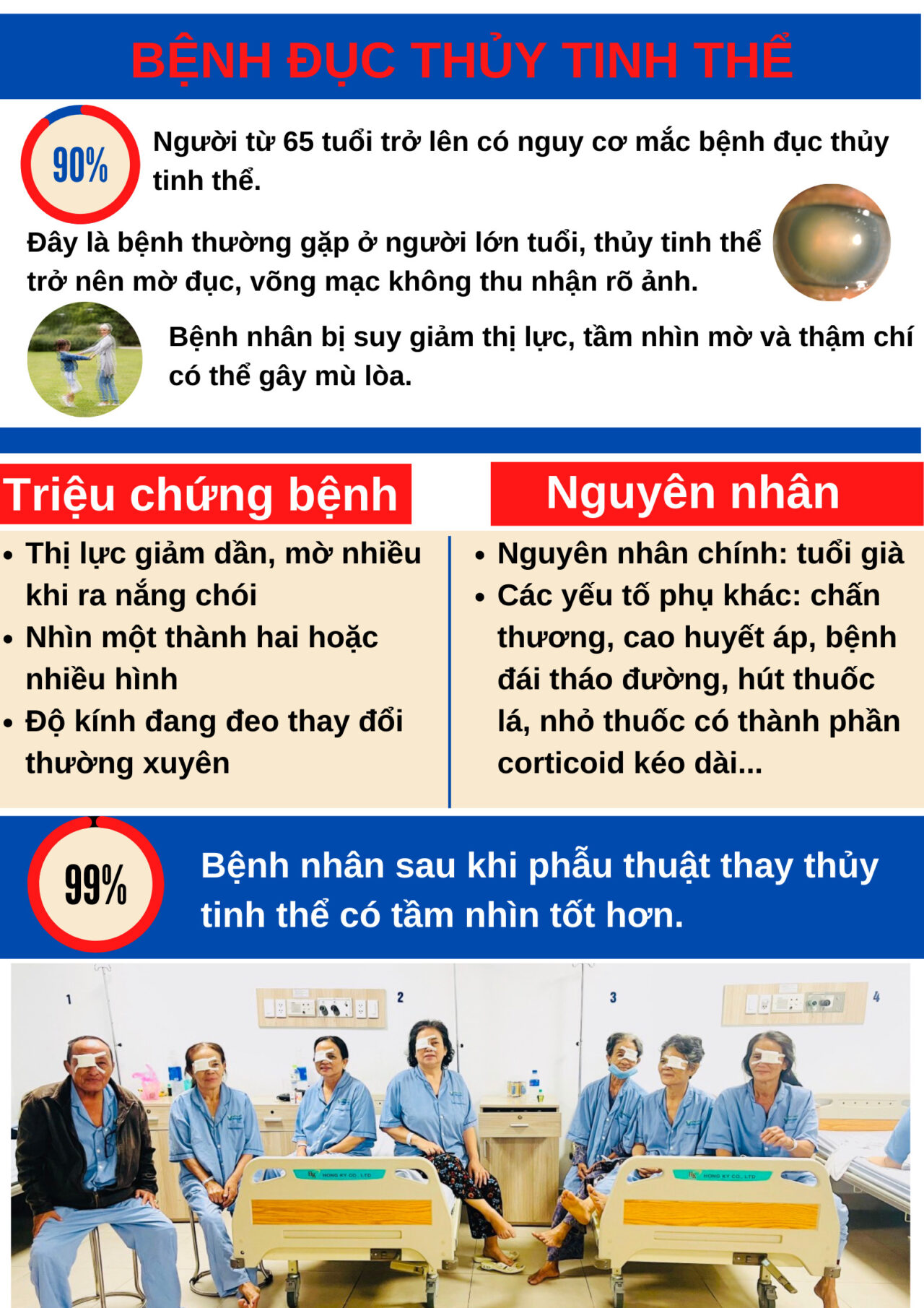 PhẪu ThuẬt Phaco ĐiỀu TrỊ ĐỤc ThỦy Tinh ThỂ Bệnh Viện Bình Định 