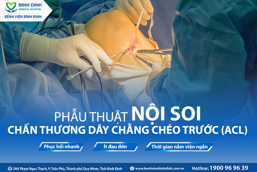 TỔN THƯƠNG DÂY CHẰNG CHÉO TRƯỚC (ACL): HIỂU, ĐIỀU TRỊ VÀ PHỤC HỒI